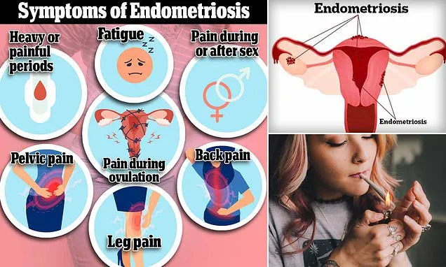 Cannabis and Managing Endometriosis Pain: Survey Highlights Patient Experiences