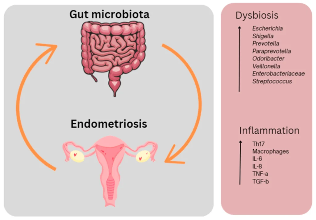 Cannabis and Managing Endometriosis Pain: Survey Highlights Patient Experiences