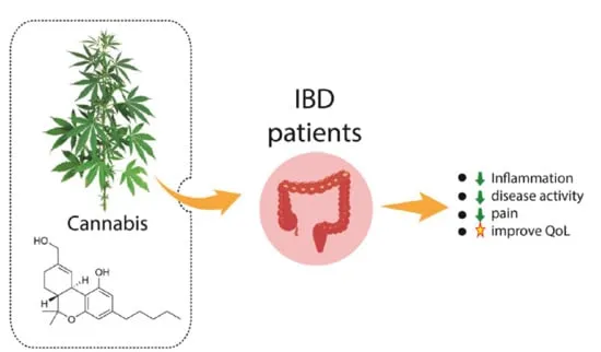 Cannabis and the Gut: Effects on Gastrointestinal Disorders